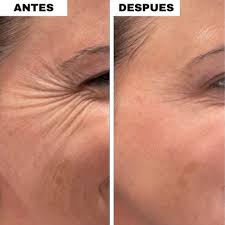 Rutina Binatural™ - Elimina las arrugas del rostro en solo 11 días. Todos te verán reluciente. (Incluye Spray Vitamina C, Bálsamo colágeno y Gratis Masajeador Luz Roja valorado en 80 euros)
